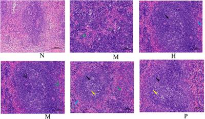 Integrated Metabolomics and Network Pharmacology Analysis Immunomodulatory Mechanisms of Qifenggubiao Granules